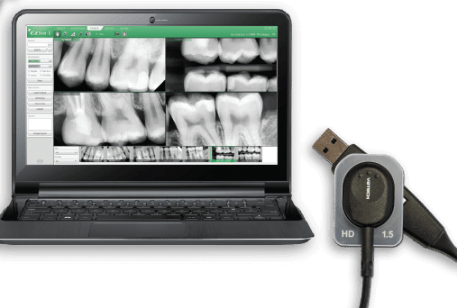 Dental X-ray imaging system displaying teeth radiographs on laptop screen with intraoral camera device.