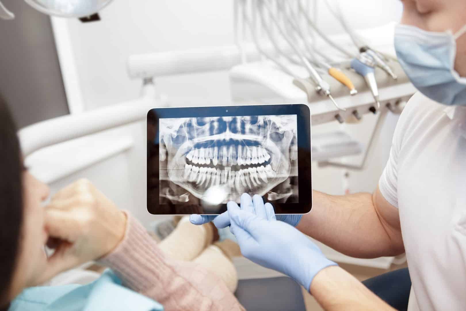 Turning Digital: New Dental Radiography Used in Dentistry