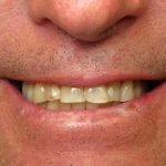 Close-up of person's smile showing teeth and mouth for dental care context.