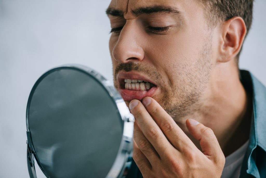 Man examining his gums in mirror, showing signs of gum discoloration and inflammation.