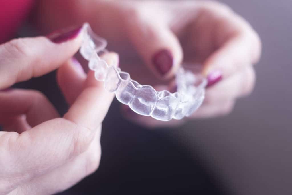 5 Things to Know Before Getting Invisalign Treatment