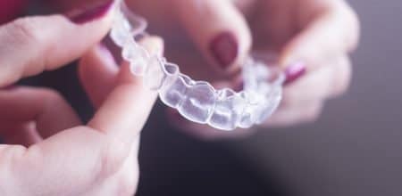 5 Things to Know Before Getting Invisalign Treatment