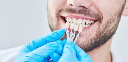 Esthetic Dentistry – What it is, Types, and What to Expect