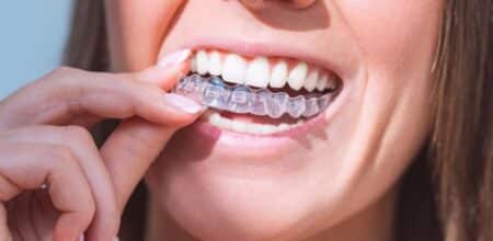 Straighten Your Smile with Invisalign: A Complete Guide