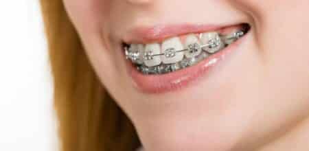 Smile Confidently: The Role Of Orthodontists In Perfecting Your Smile