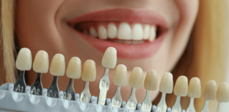 Smile Makeovers: What a Cosmetic Dentist Can Do for You