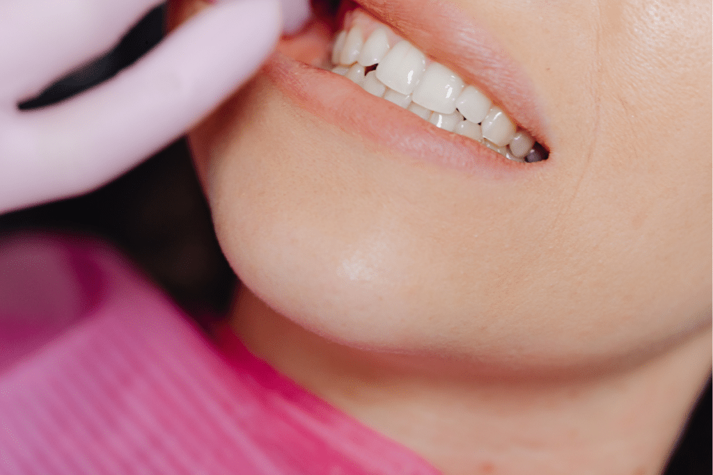 White Spot treatment in Jupiter FL
