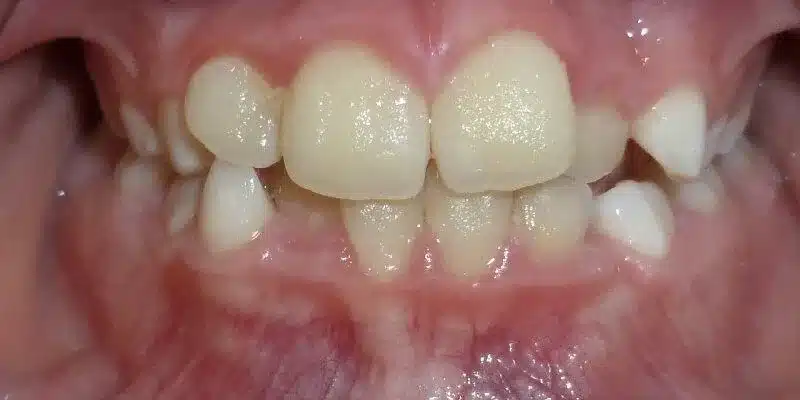 Before Image