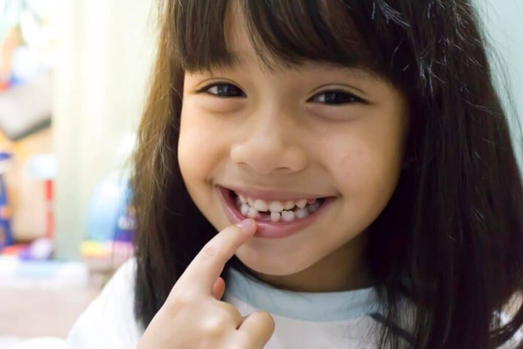 a smiling girl needs early orthodontic treatment