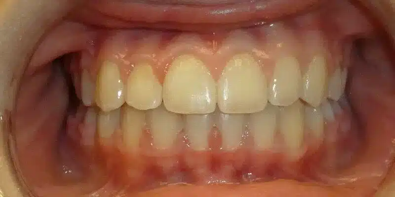After Image