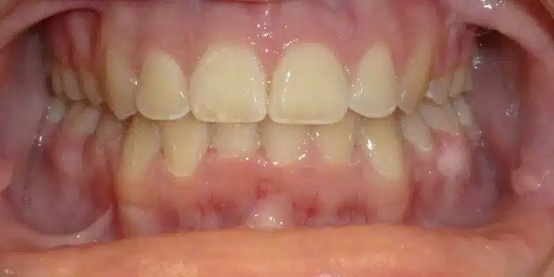 After Image