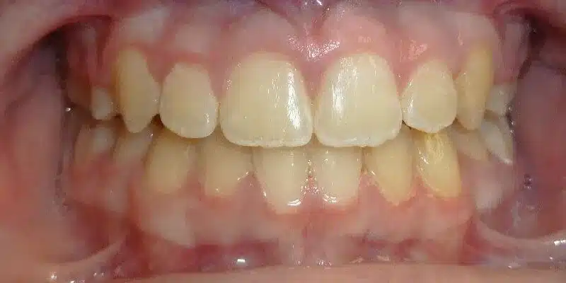 After Image