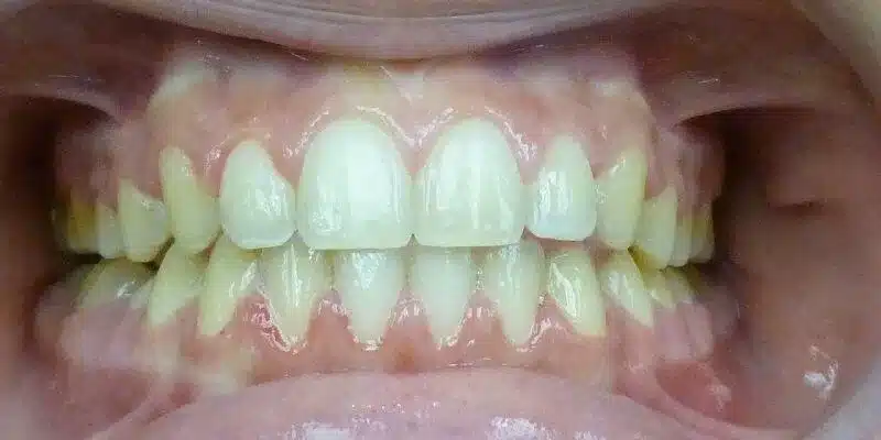 After Image
