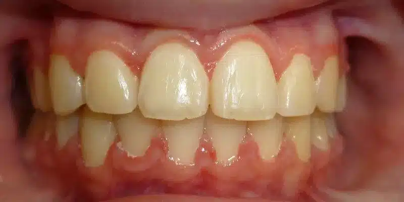 After Image