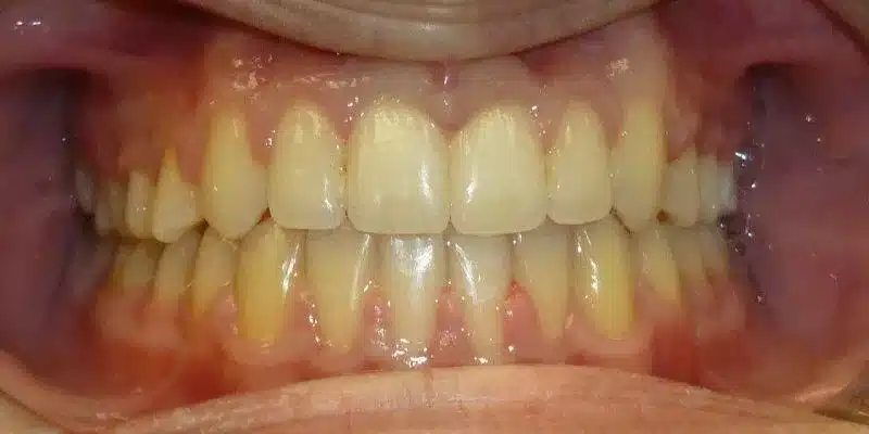 After Image