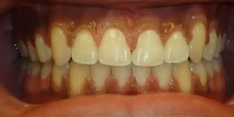 After Image