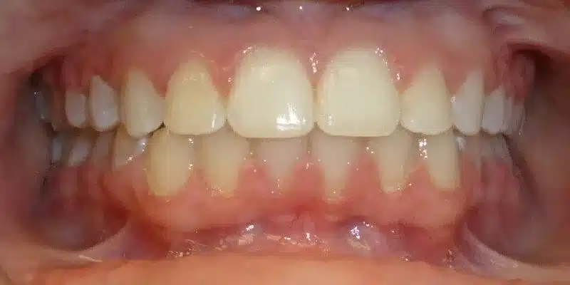 After Image