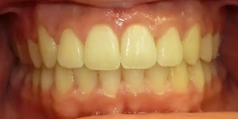After Image