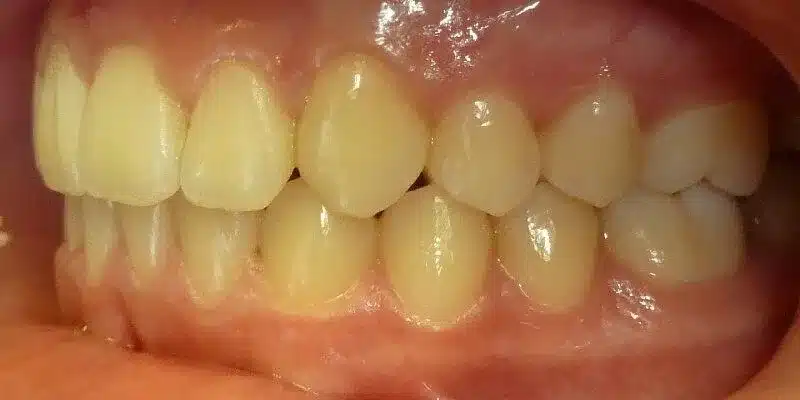 After Image