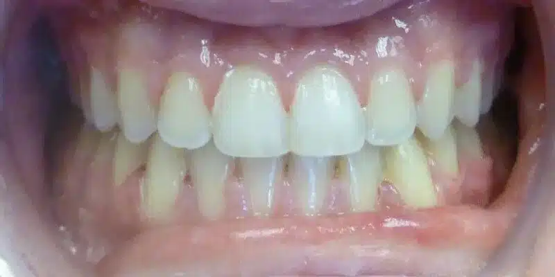 After Image