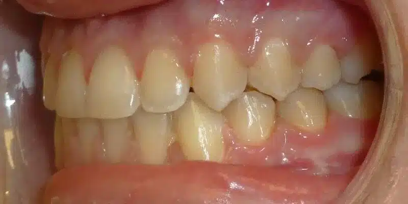 After Image