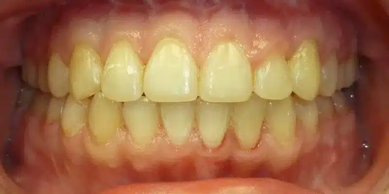 After Image