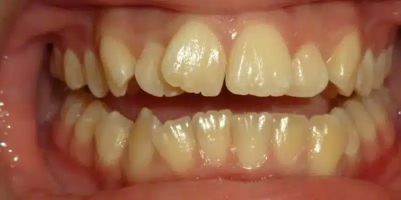 Before Image