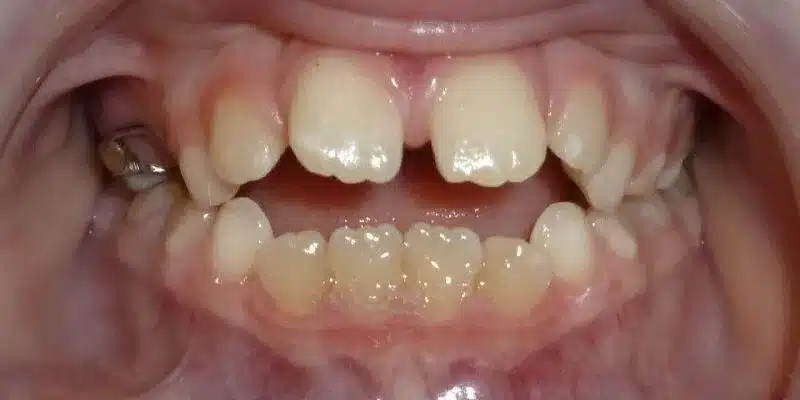 Before Image