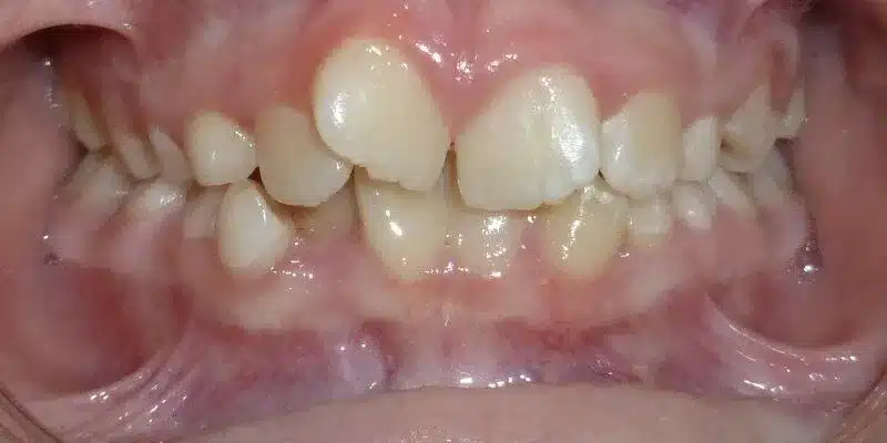 Before Image
