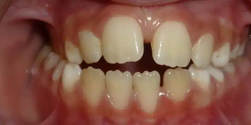 Before Image