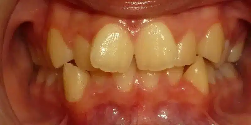 Before Image