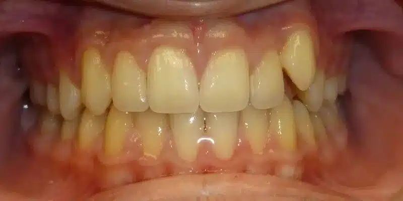 Before Image