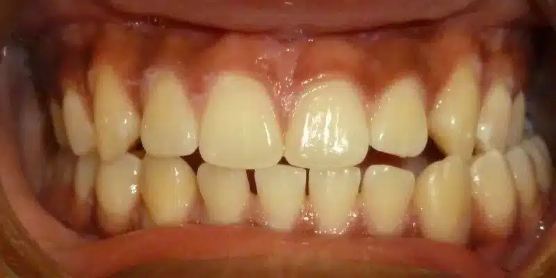 Before Image