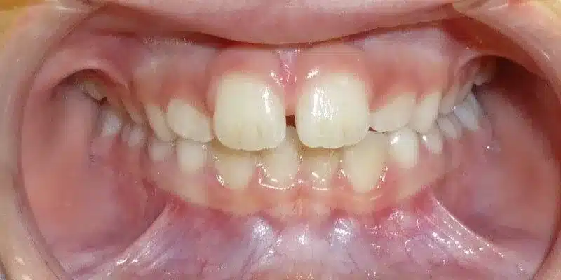 Before Image