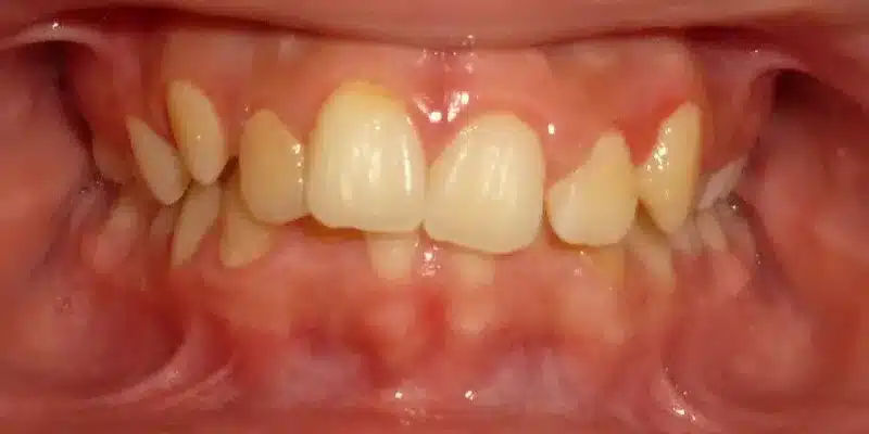 Before Image