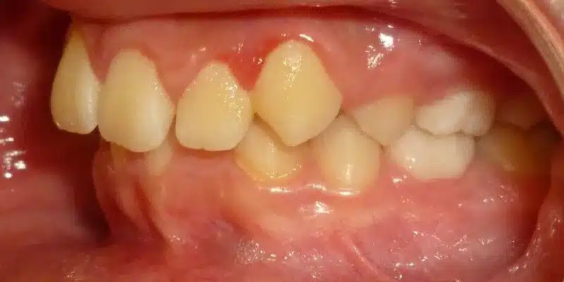 Before Image
