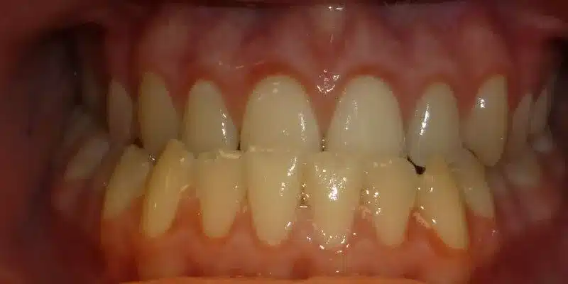 Before Image
