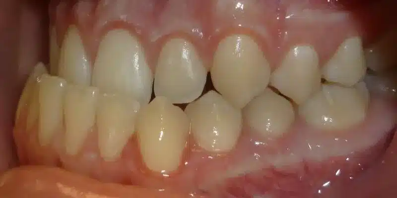 Before Image