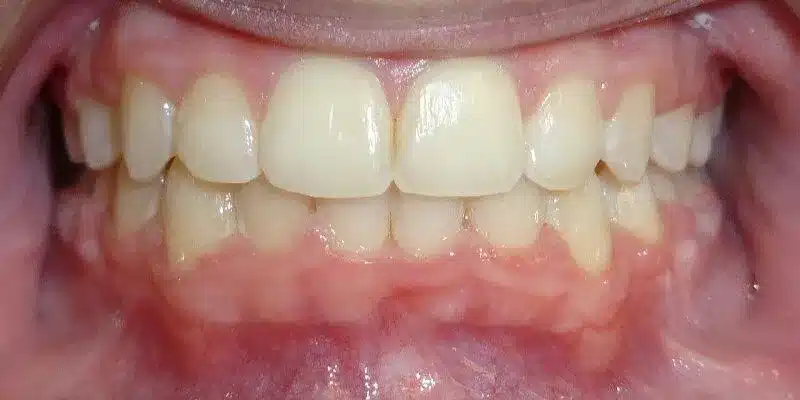 After Image