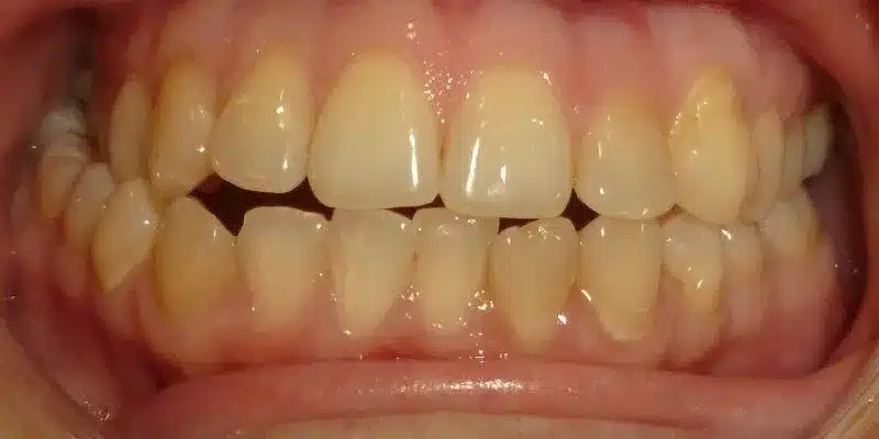 Before Image