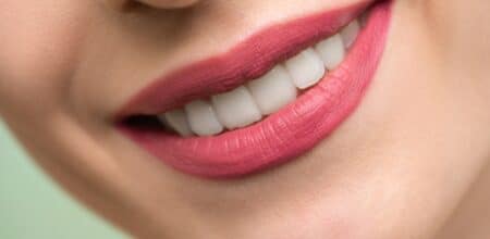 Revitalize Your Smile: 5 Compelling Reasons to Choose Teeth Whitening