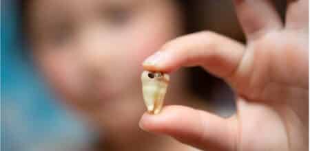 The Hidden Risks of Tooth Decay: What You Need to Know
