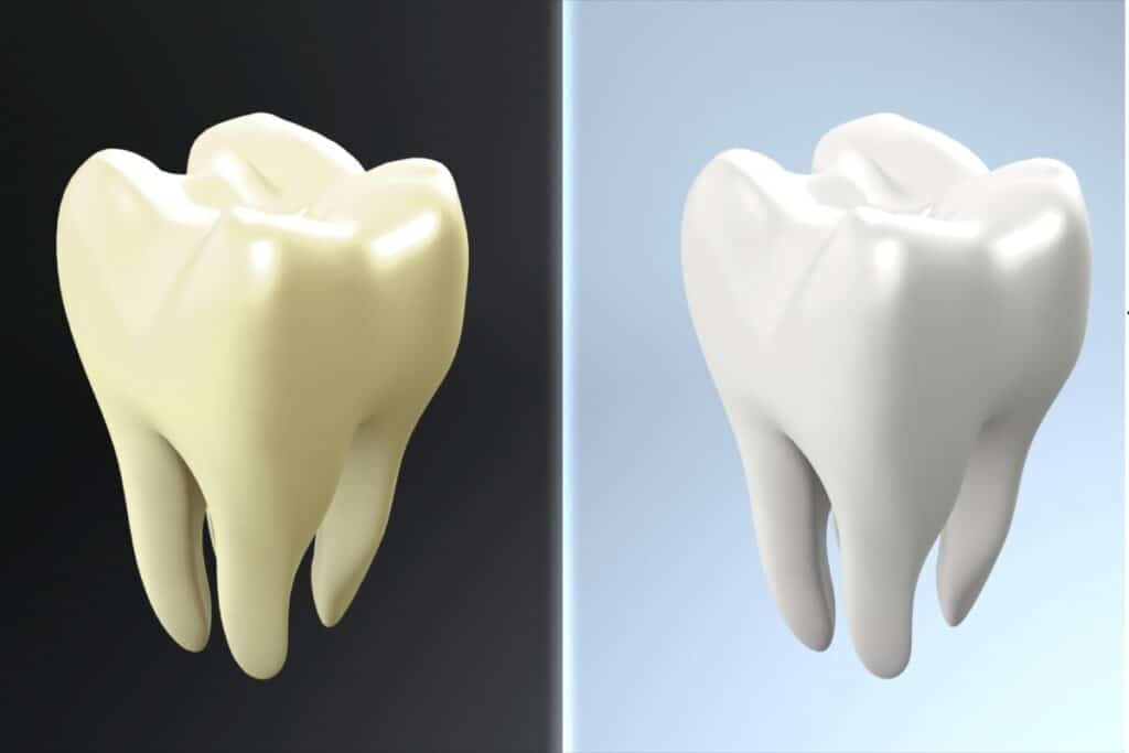 Green Tooth