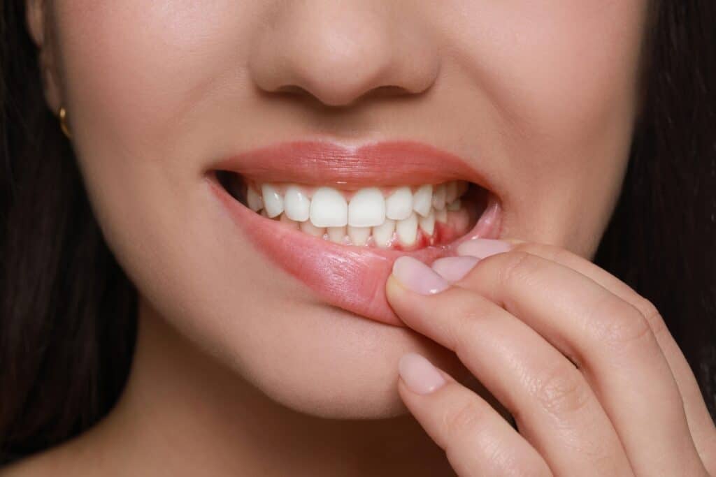 Dry Gum Socket solution by Dentist in Jupiter