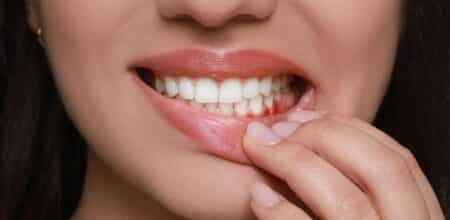 Understanding Dry Socket vs Normal Socket: Causes, Symptoms & Treatments