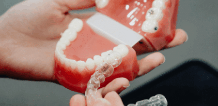 Why You Might Need Invisalign Refinements During Your Treatment