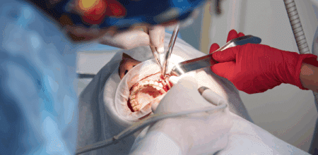Orthognathic Surgery: What It Is and When You Might Need It