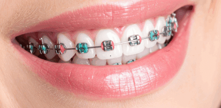 The Mechanics of a Masterpiece: Why Proper Jaw Alignment is the Secret to a Great Smile