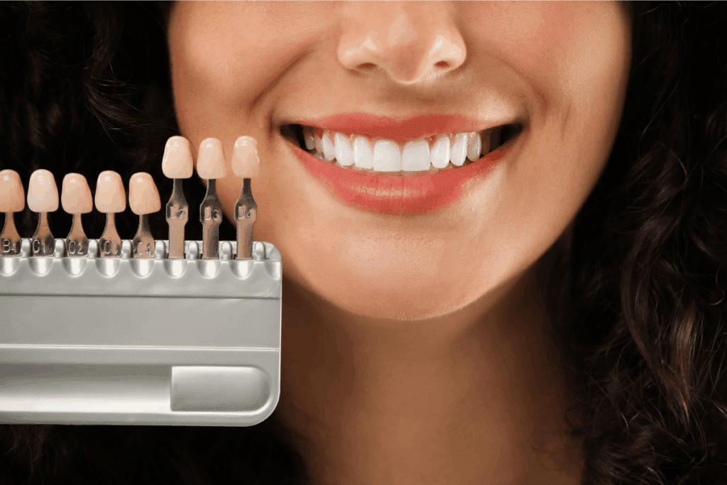 Get Natural-Looking Veneers in Jupiter
